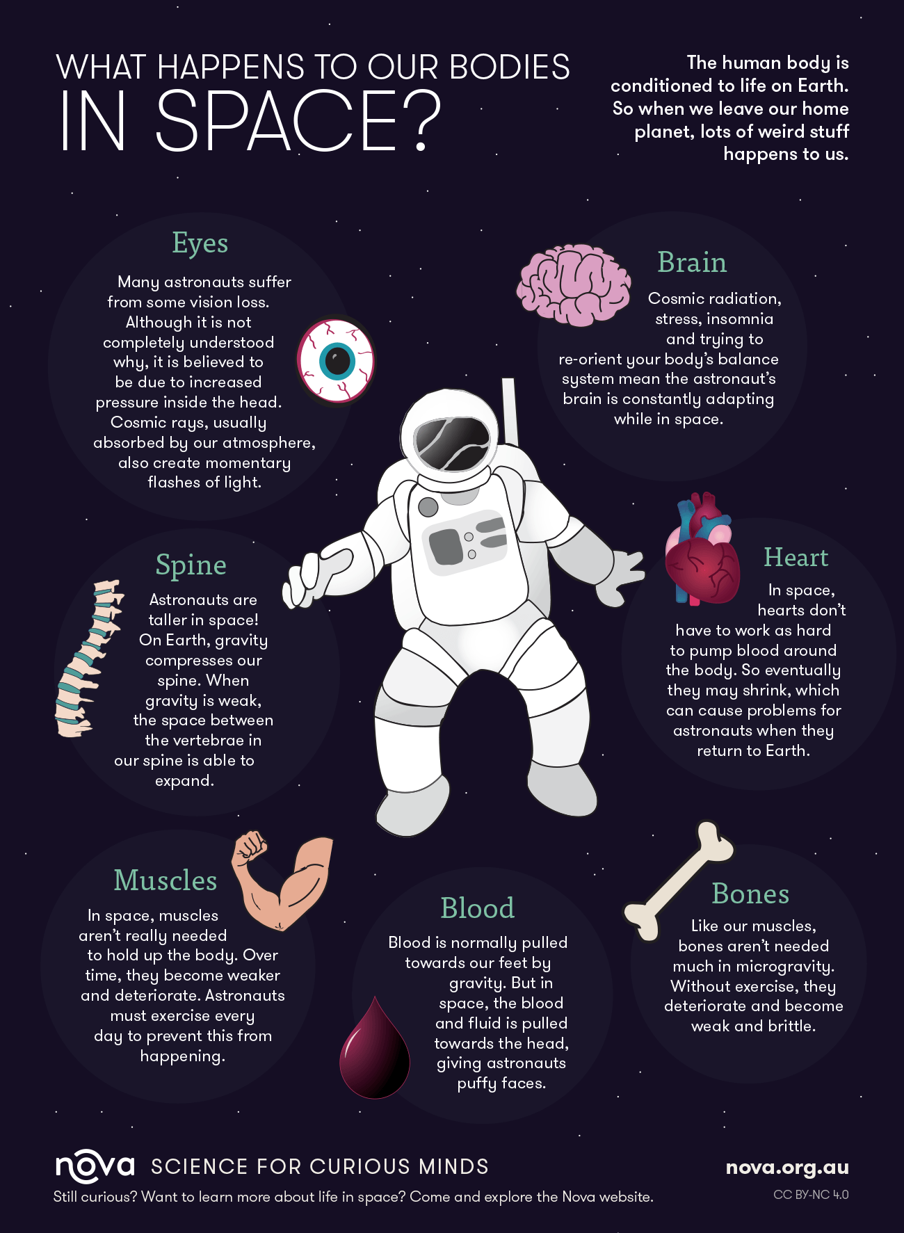 What Would Happen To A Dead Body In Space?
