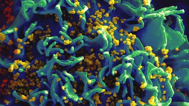 HIV-infected H9 T-cell